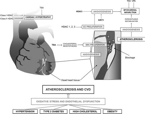 Angiogenesis and Cardiovascular Diseases: The Emerging Role of HDACs ...