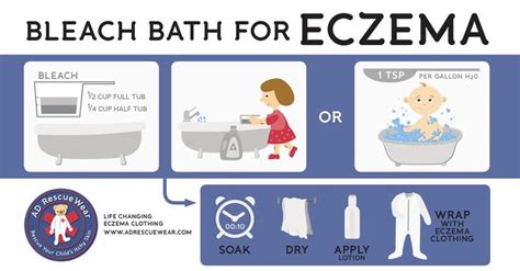 Baths for Eczema - 5 Baths to Bring Relief. | Bleach bath for eczema ...