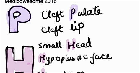 Medicowesome: Fetal Hydantoin syndrome mnemonic