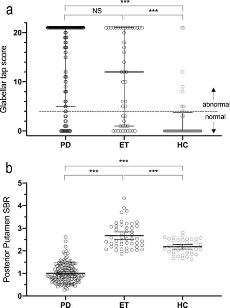 Glabellar tap score and specific binding ratio of the PD, ET and HC ...