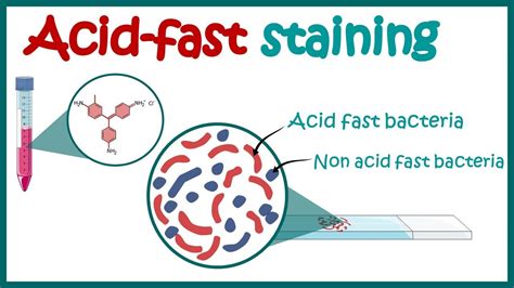 ACID FAST STAINING | Acid fast organisms | Bacterial Staining Technique ...