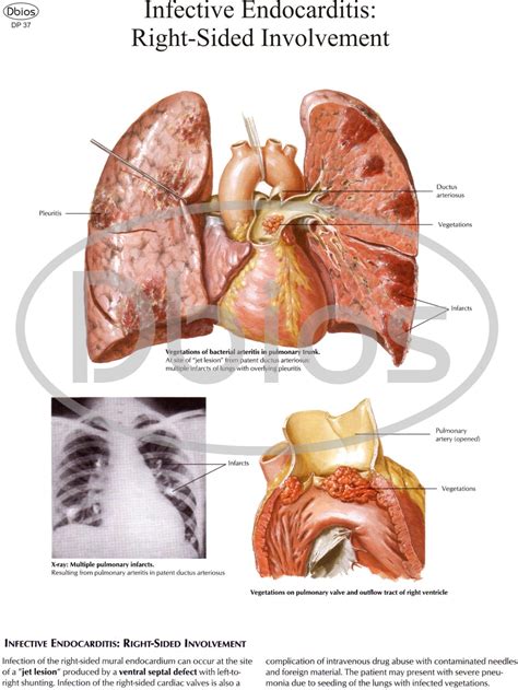 Pathology Charts -Pioneers – For Classes, Not Masses