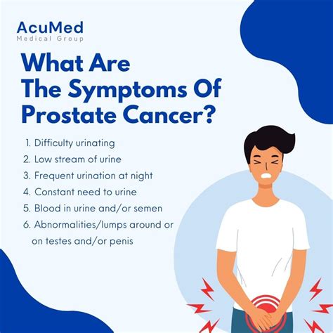 Learn The Symptoms Of Prostate Cancer Choi Urology | Hot Sex Picture