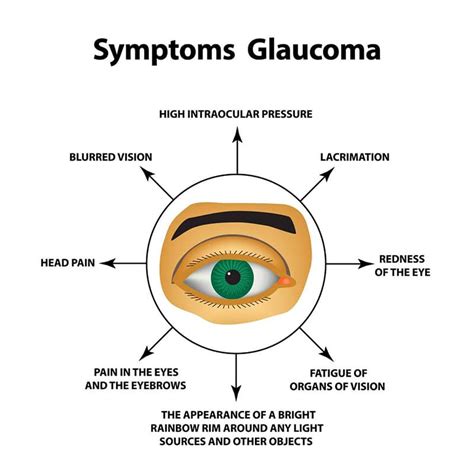 What is Glaucoma | Georgia Eye Clinic