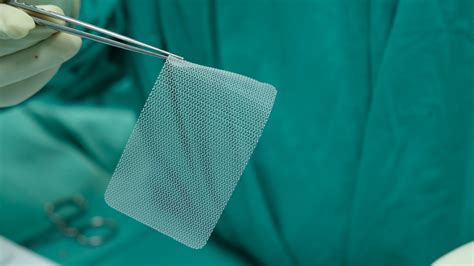 Hernias & Surgical Repair with Mesh Implants: What Should You Know?