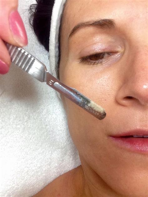 Dermaplaning Facial Review: A Simple Way To Get Glowing Skin With No ...