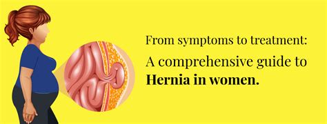 Postpartum Hernia Causes Signs And Symptoms Diagnosis And Treatment ...