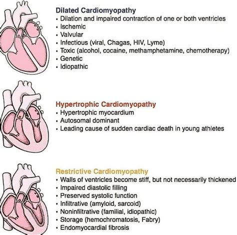 Types of cardiomyopathy - MEDizzy