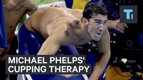 Michael Phelps' cupping therapy - YouTube