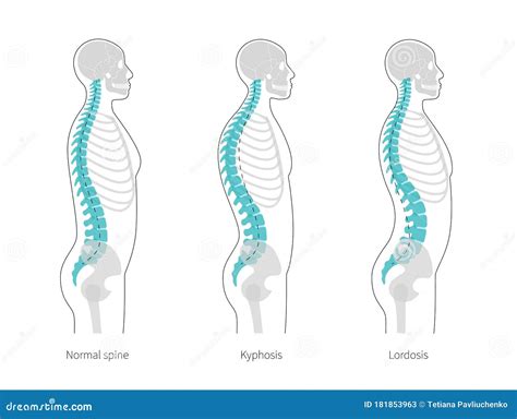 Diagram Of Backbone - Anatomy Of The Spine And Back / In this ...