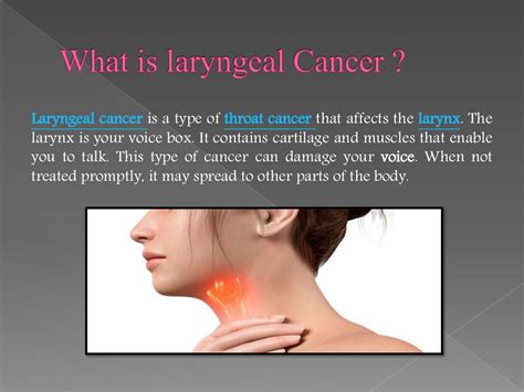 Signs, Symptoms and Treatment of Laryngeal Cancers