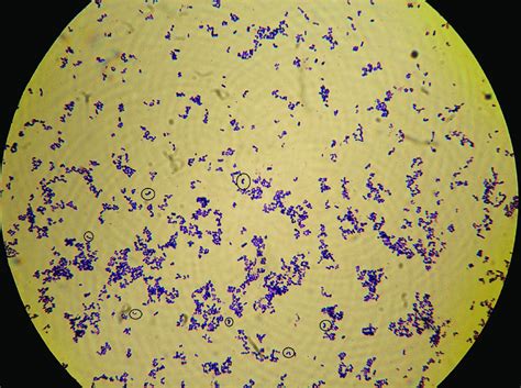 Morphological visualisation of Corynebacterium sp. after Gram stain ...