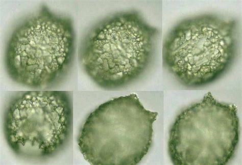 Protist Images: Difflugia corona