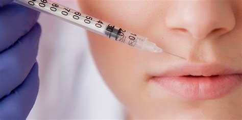 BOTOX Lip Flip Overview: Everything You Want to Know