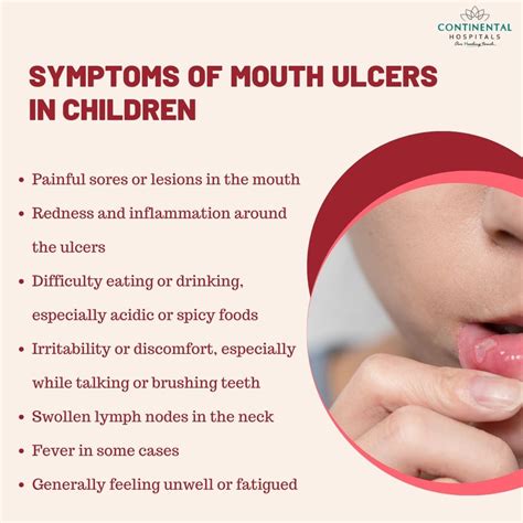 Swollen Mouth Ulcers Causes - Infoupdate.org