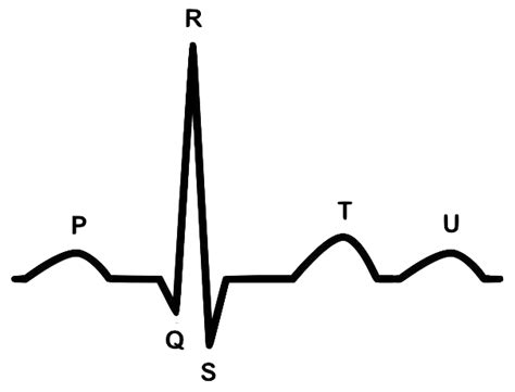 The Basic Guide to ACLS ECG Interpretation