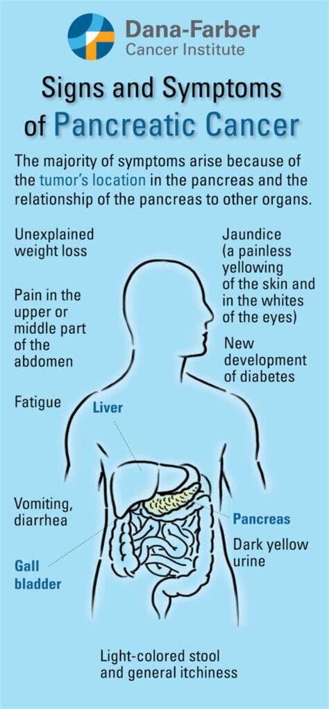 Pancreatic Cancer Symptoms | Dana-Farber Cancer Institute