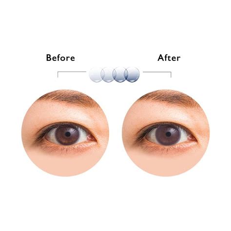 Acuvue Oasys with Transitions Bi-Weekly (6 lenses pack) – ezylens