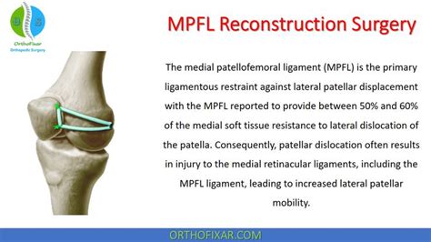 MPFL Reconstruction Surgery | Surgery, Knee surgery, Subluxation