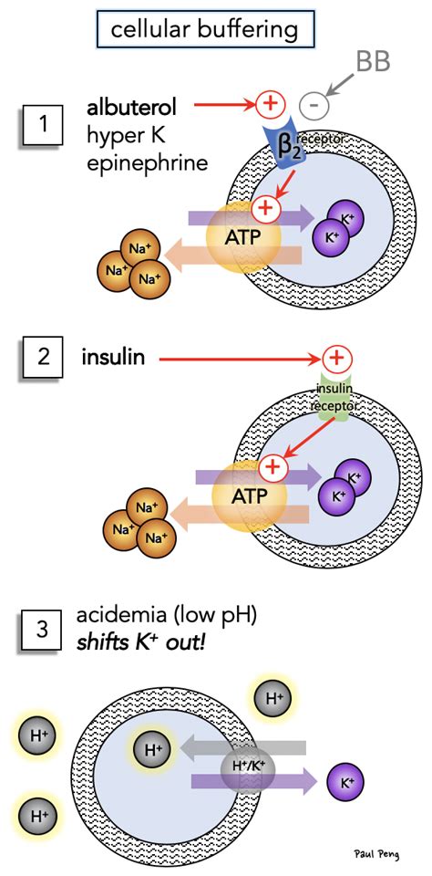 hyperkalemia physiology – Sinai EM