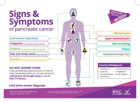 Research solves pancreatic cancer mystery – The Pembrokeshire Herald