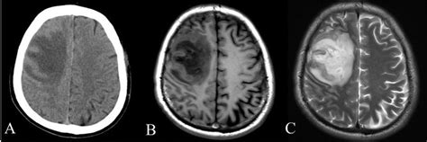 What is the Difference Between a CT Scan and an MRI? | ImageCare Centers