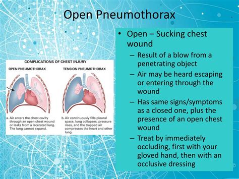 PPT - Chest Trauma PowerPoint Presentation, free download - ID:5319182