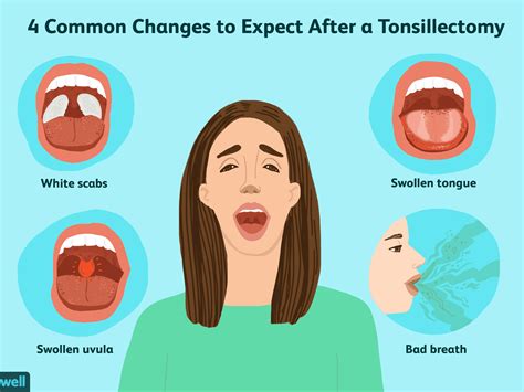 Parts Of Mouth And Throat