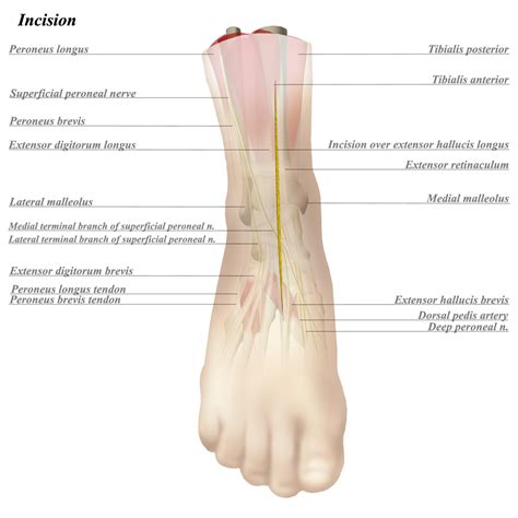 Ankle Anterior Approach - Approaches - Orthobullets