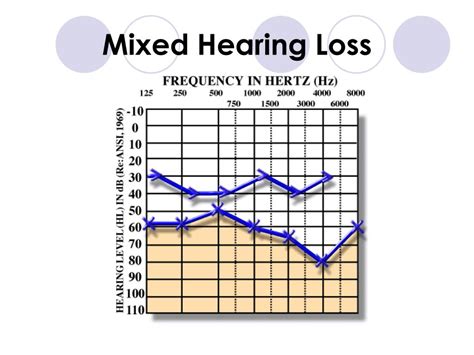 PPT - Reading an Audiogram PowerPoint Presentation, free download - ID ...