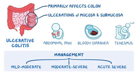 Ulcerative Colitis – Symptoms, Causes, Types And, 48% OFF