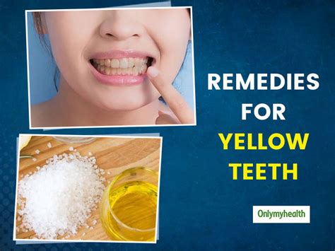 Try These 6 Effective Home Remedies To Whiten Yellow Teeth | OnlyMyHealth