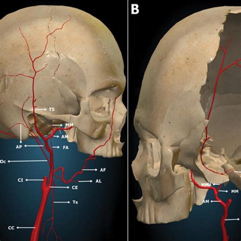 (PDF) Anatomy of the Middle Meningeal Artery