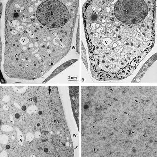 Electron micrograph of a columella cell (A) in a longitudinal section ...