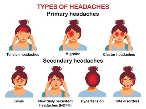 Vektor Stok Headache Types Infographics Different Symptoms Headache ...