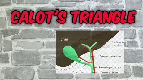 calot's triangle anatomy - YouTube