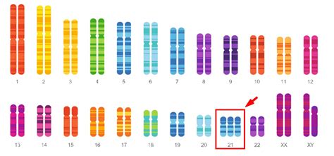 Chromosome Aneuploidies | Xcelom