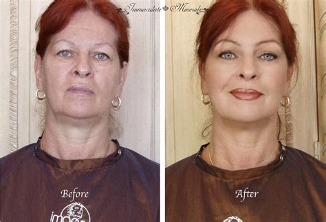 Before & After Photos - Immaculate Minerals® & Immaculate Anti-Aging ...