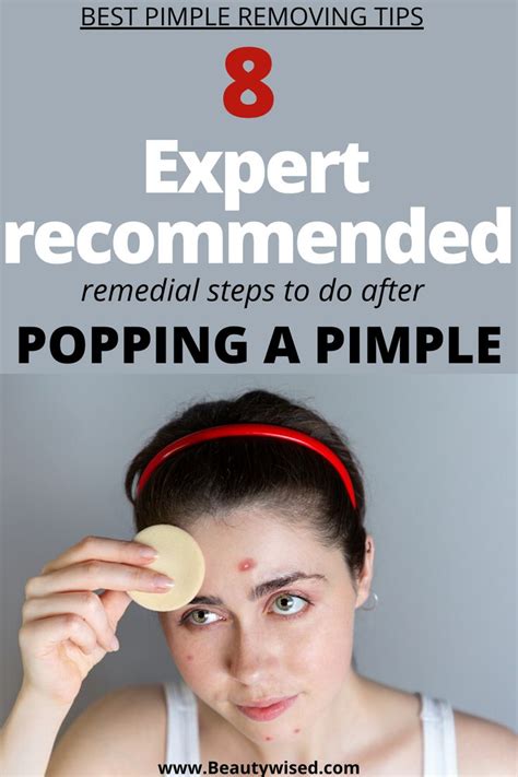 The Best pimple popping tips on how to properly pop a pimple or how to ...