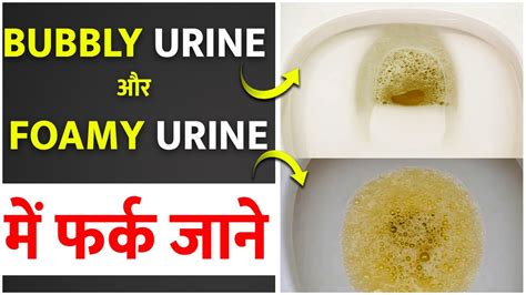 What Causes Foamy Urine In Dogs