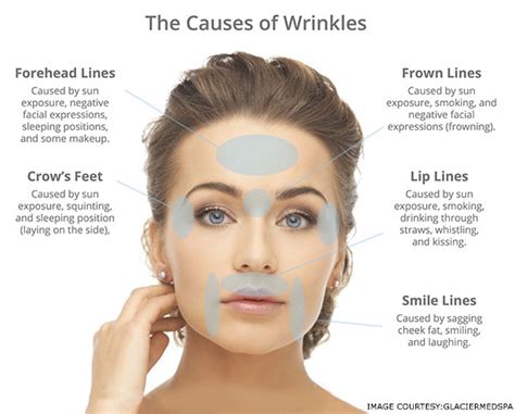 Why Does Skin Wrinkle With Age And What’s The Best Way To Prevent It?