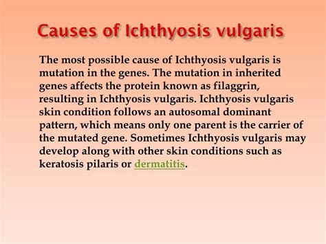 PPT - Ichthyosis Vulgaris: Symptoms, Causes, Diagnosis and Treatment ...