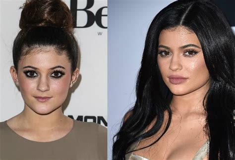 New And Improved! The Top 15 Celebrity Plastic Surgeries For The Win