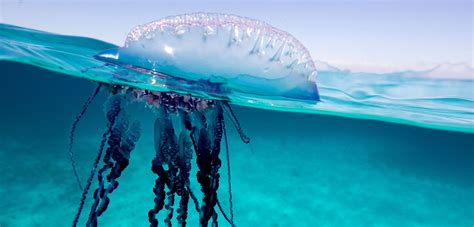 How To Fix a Jellyfish Sting | Hakai Magazine