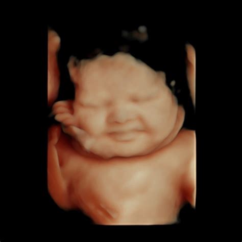 When Is the Best Time to Get a 3D/4D Ultrasound? - The Ultrasound ...