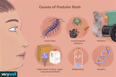 Pustular Rash Causes, Symptoms, and Treatments