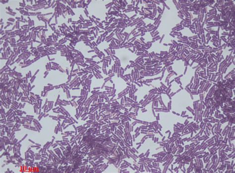 Gram-Positive Bacilli (Rods) - Microbiology learning: The "why"ology of ...