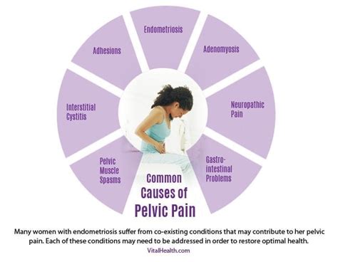 causes-of-pelvic-pain | Vital Health Endometriosis Center