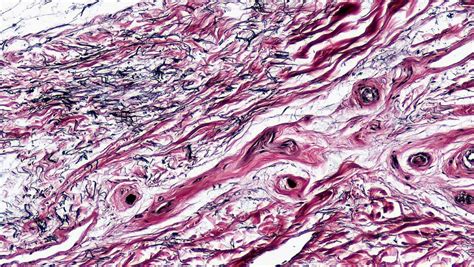 Connective Tissue - Definition, Types, Functions, Structure