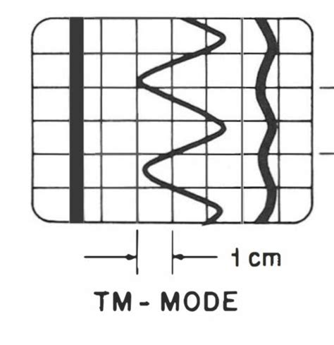 Ultrasound Mode Display. - radiologystar